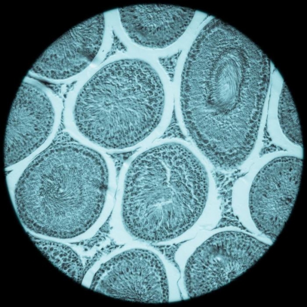 Тайны черных трансплантологов