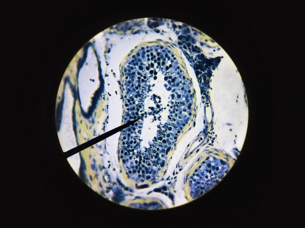 Тайны черных трансплантологов