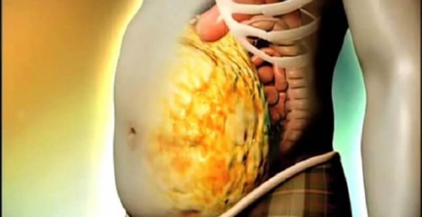 Домашние способы выведения опасных токсинов из организма