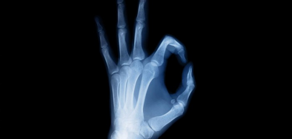 Перелом костей: симптомы и диагностика