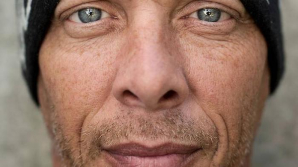 Американец, ударившись головой, на утро проснулся виртуозным музыкантом