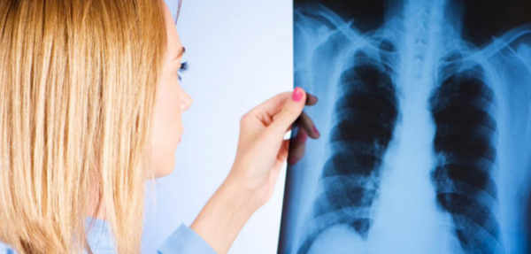 Разработана новая вакцина от туберкулеза