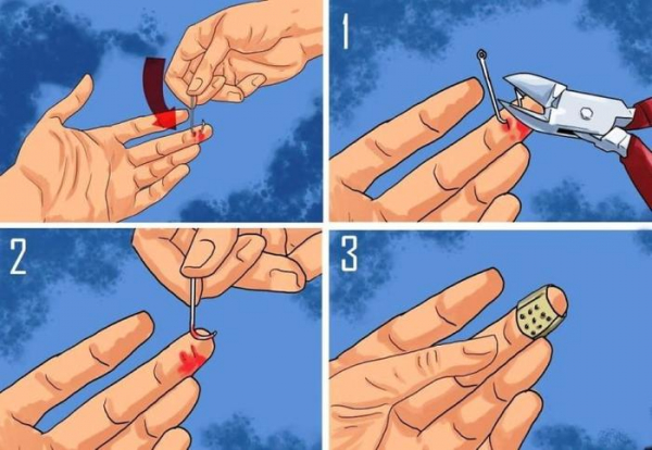 Как вытащить рыболовный крючок из пальца?