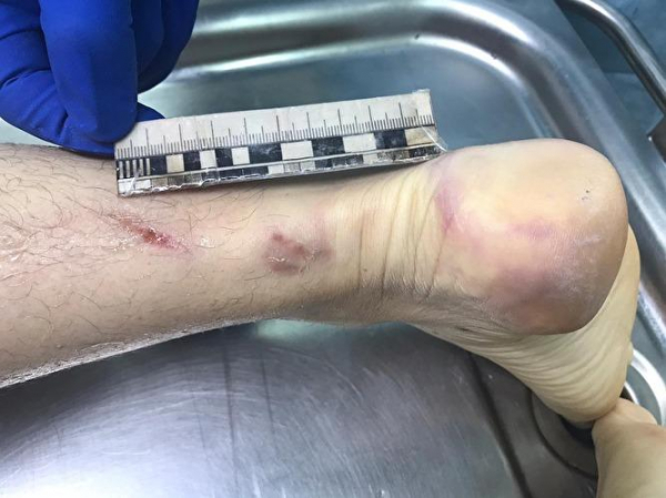 &laquo;Бастрыкин дал приказ &mdash; раскрыть дело за две недели. Вот они и раскрывают&hellip;&raquo;