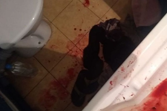 СК проводит проверку из-за смерти журналиста, которому медики останавливали кровотечение